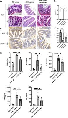 Ursodeoxycholic Acid Treatment Restores Gut Microbiota and Alleviates Liver Inflammation in Non-Alcoholic Steatohepatitic Mouse Model